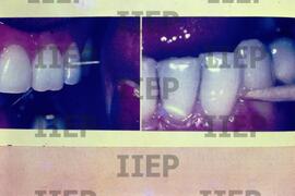 Saúde : BR-SPIIEP_INF-EDP-DPS_SAU-011-08 [diapositivo]