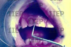 Saúde : BR-SPIIEP_INF-EDP-DPS_SAU-023-12 [diapositivo]