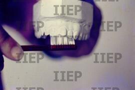 Saúde : BR-SPIIEP_INF-EDP-DPS_SAU-010-16 [diapositivo]