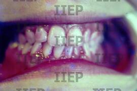 Saúde : BR-SPIIEP_INF-EDP-DPS_SAU-009-07 [diapositivo]
