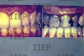 Saúde : BR-SPIIEP_INF-EDP-DPS_SAU-023-15 [diapositivo]
