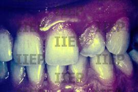 Saúde : BR-SPIIEP_INF-EDP-DPS_SAU-011-10 [diapositivo]