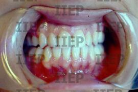 Saúde : BR-SPIIEP_INF-EDP-DPS_SAU-009-15 [diapositivo]
