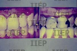 Saúde : BR-SPIIEP_INF-EDP-DPS_SAU-011-16 [diapositivo]
