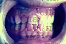 Saúde : BR-SPIIEP_INF-EDP-DPS_SAU-018-14 [diapositivo]